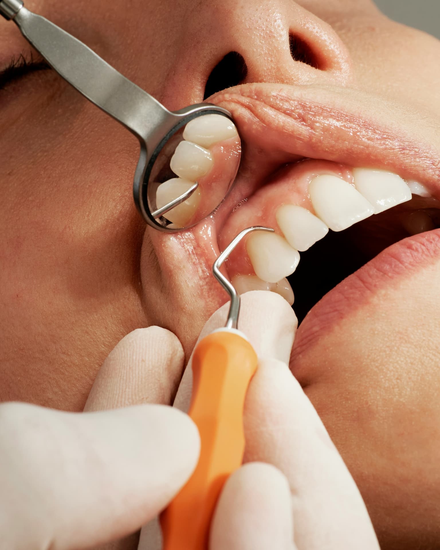 Igiene e prevenzione - Studio Dentistico Silvia Babboni