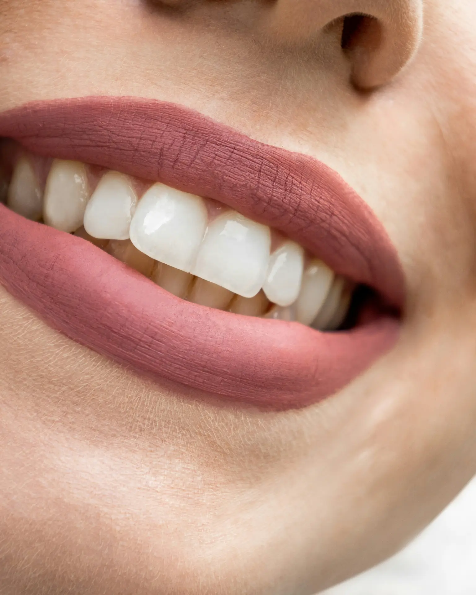 Odontoiatria estetica - Studio Dentistico Silvia Babboni