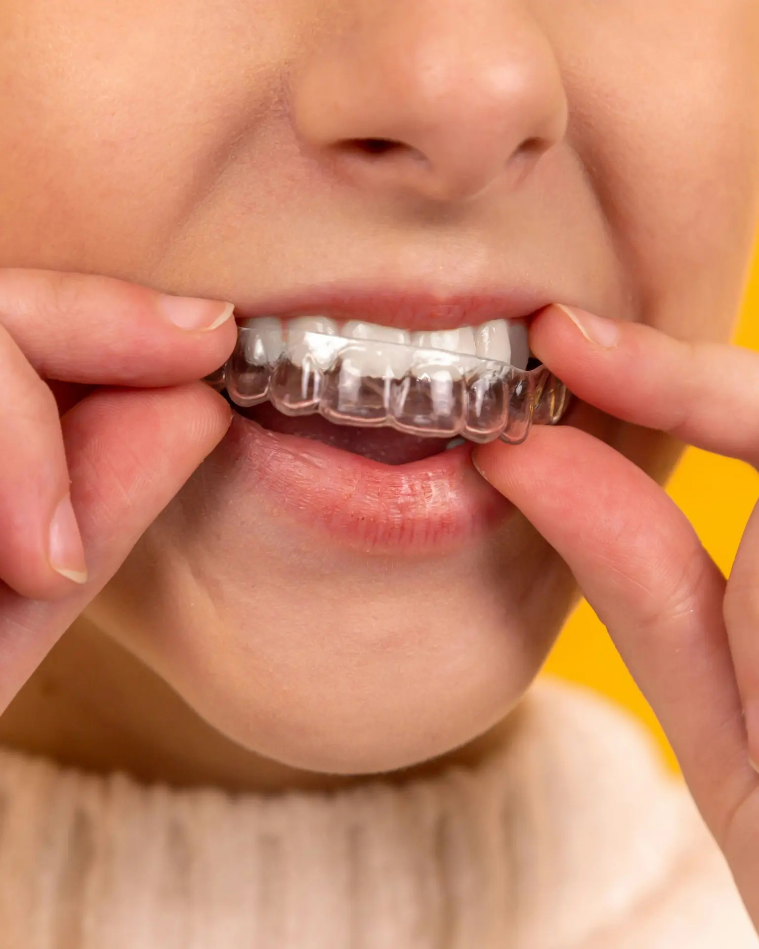 Ortodonzia e allineatori invisibili - Studio Dentistico Silvia Babboni